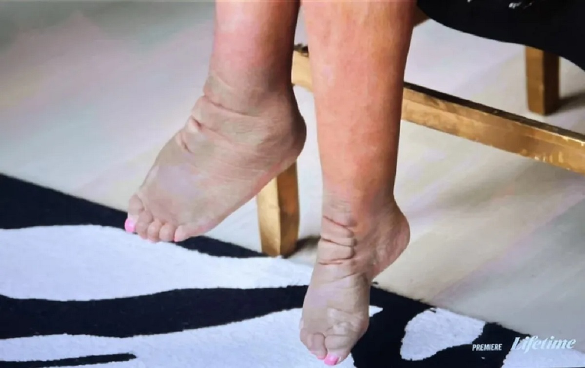 What Happened To Wendy Williams Feet? Surgery And Health 2024 - Coza24 ☑️