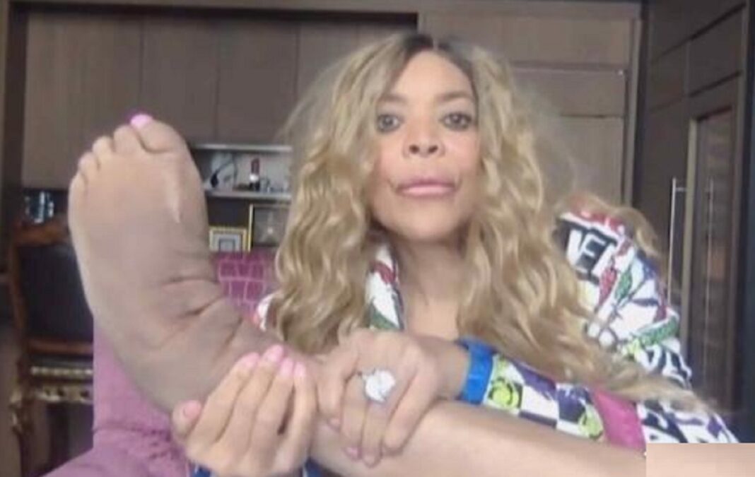 What Happened To Wendy Williams Feet? Surgery And Health
